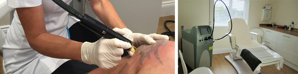 Alexandrite Laser Hair Removal What You Need To Know